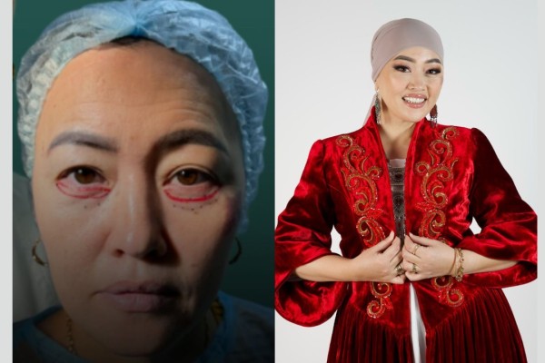 Денсаулық берсін: Наркенже Серікбаеваға ауыр операция жасалды (ВИДЕО)