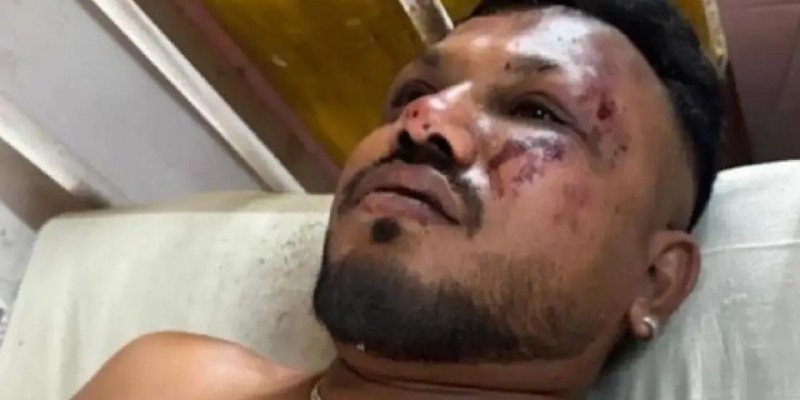 Үндістандағы ұшақ апатынан 241 адам қаза тауып, 1 адам ғана аман қалған (видео)